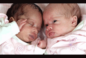 Thêm một cặp song sinh da đen, da trắng