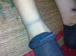 Khởi tố bị can 4 công an xã đánh chết dân tại trụ sở