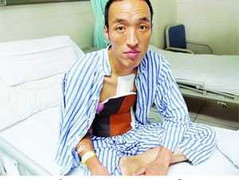 Người đàn ông có máu màu tím