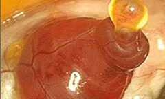 'Giải mã' những bí ẩn về hiện tượng rụng trứng