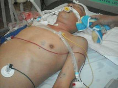 Tử vong sau khi được đưa về từ công an phường