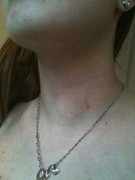 Đã có lời giải thích về bí ẩn làn da màu xanh