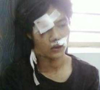 Giáp mặt tên cướp giết người giữa phố Sài Gòn