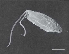 Bé trai tử vong do amip ăn não không tắm ao, hồ