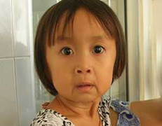 Trẻ em bị lão hóa: Đã có thuốc chữa trị