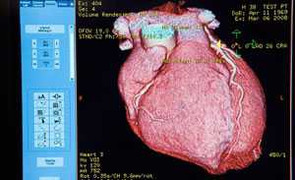 Chàng trai có trái tim tự phục hồi kỳ diệu