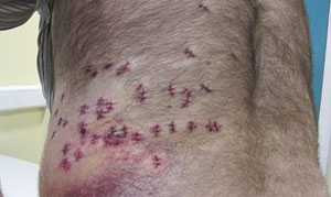 Bị đâm 40 nhát vẫn thoát chết nhờ béo