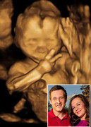 Bức ảnh thai nhi mỉm cười và giơ tay hình chữ V