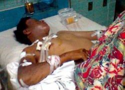 Đào móng hàng rào, cuốc trúng bom bi