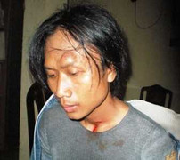 Sẽ đưa kẻ bắt cóc trẻ mầm non giám định tâm thần