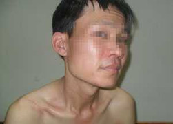 Kiến ba khoang 'tấn công' người Hà Nội