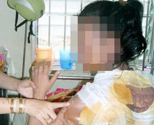 Vợ trẻ bị chồng vũ phu tạt nước sôi khắp mặt