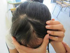 Truy bắt kẻ đánh vỡ đầu nữ phóng viên