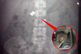 Ăn đá bào nuốt luôn... lưỡi dao