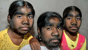 Những trường hợp biến đổi gen kì lạ trên thế giới