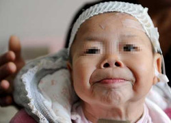 Chuyện lạ: Bé gái 1 tuổi bỗng dưng hóa bà lão 80