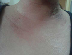 Sinh viên tá hỏa với kiến ba khoang