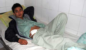 Suýt chết vì đau ruột thừa chẩn đoán thành...đau dạ dày