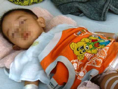 Cắt nhầm bàng quang bé trai 21 tháng tuổi