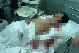 Xe chở rác kéo lê người trên đường