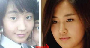 Thảm họa từ phẫu thuật thẩm mỹ giá rẻ