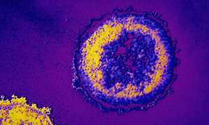 Tìm ra kháng thể diệt virus HIV hiệu quả