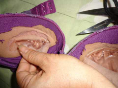 Chất lạ trong áo ngực gây ung thư, rối loạn nội tiết?