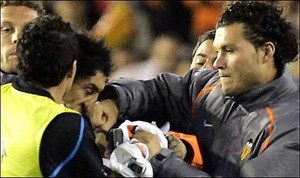 Kẻ đánh Ronaldo chảy máu từng đấm đối phương vỡ mũi