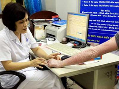 Viêm da mùa lạnh: Bác sĩ khuyến cáo gì?