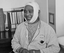 Mắc bệnh, người đàn ông 30 năm không mở được miệng