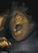 Hình ảnh thai nhi ngáp trong bụng mẹ