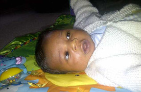 Những tình huống hi hữu phát hiện bệnh nan y