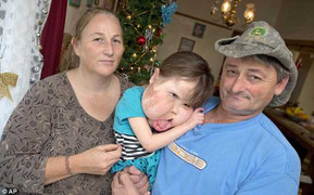 Cảm thương bé có khuôn miệng khổng lồ