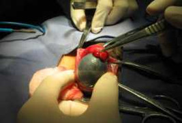 Tự dùng kháng sinh, hoại tử tinh hoàn