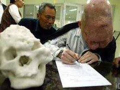 Người đàn ông ‘mặt sư tử’