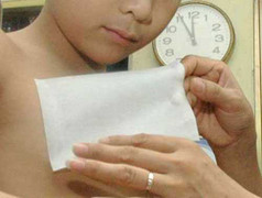 Bỏng sau khi dùng miếng dán giữ nhiệt