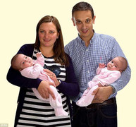 Tách cặp song sinh chung ruột 1 ngày tuổi