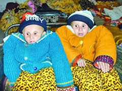 Hai anh em 7 tuổi cùng già như cụ 70