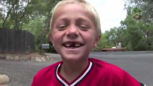 Những cách nhổ răng cực độc đáo