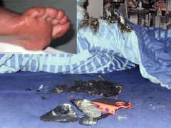 Điện thoại xịn phát nổ, bé trai bị bỏng