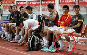 Cầu thủ mắc bệnh ngôi sao, cá nhân chủ nghĩa