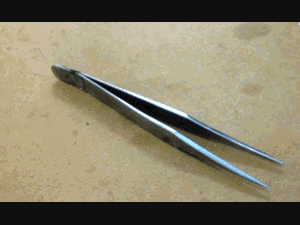 Nuốt nhíp sắt dài 12 cm, thủng ruột non