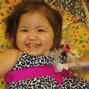 Nội tạng lòi ra ngoài, bé gái sống sót sau 28 lần mổ