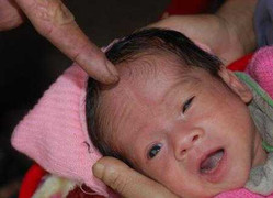 Lạ lùng vùng đất có căn bệnh mở hộp sọ