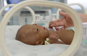 Kỳ lạ bé sơ sinh chỉ nặng...5 lạng