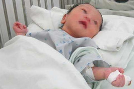 Bí ẩn đằng sau vụ mẹ cắn đứt ngón tay con mới sinh