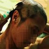 Khởi tố nhóm giang hồ đất Cảng gọt đầu giám đốc 3 chỏm