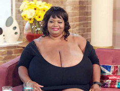 Phẫu thuật vì ngực khủng gấp 10 lần bình thường