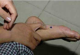 Bức thư cầu cứu xúc động của nam sinh bị ung thư