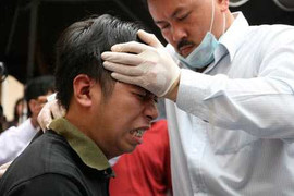 Khuôn mặt nham nhở sẹo và rùng rợn một kiếp giang hồ